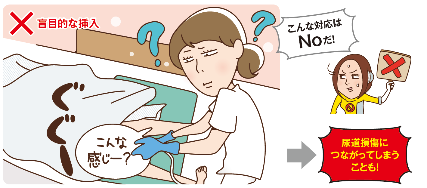 女性の尿管カテーテルはなぜ痛い？手術・抜去時の激痛理由と対処法