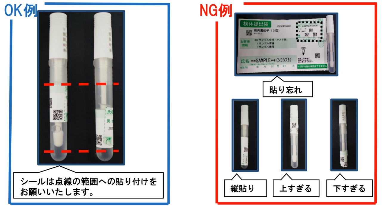 検便の取り方完全マニュアル！洋式の失敗防止策から下痢・保存法まで