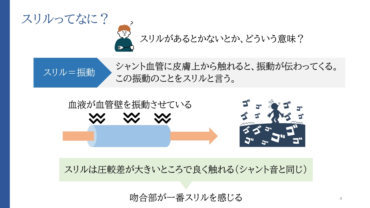 シャントのスリルとは？ドクドク拍動との違いと閉塞を防ぐ緊急サイン