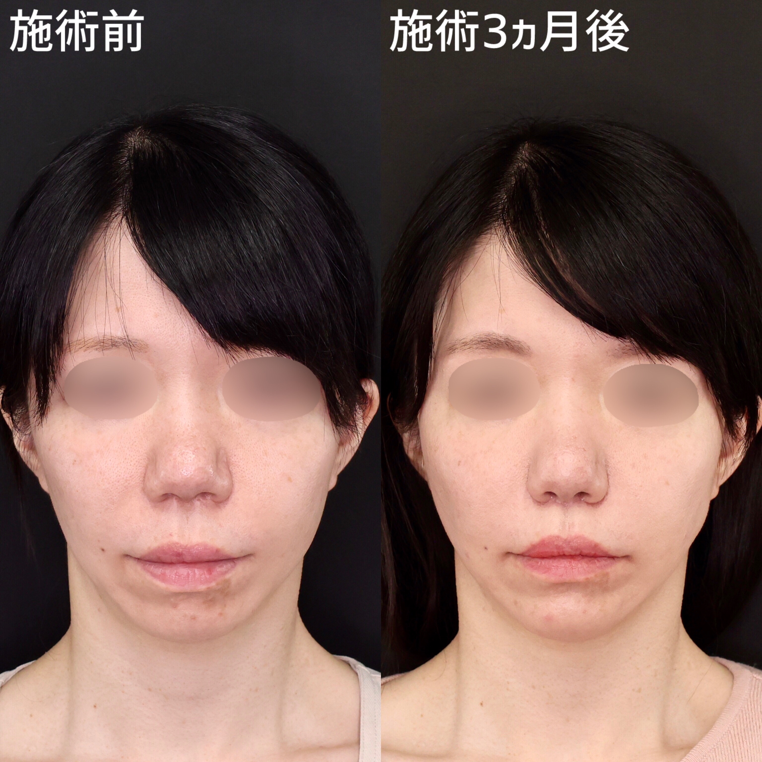 顎が長い人の特徴と魅力｜原因から髪型・メイク・骨格改善まで徹底解説