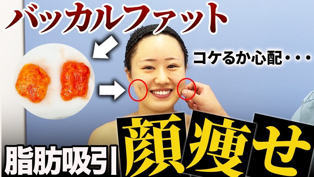 頬の内側を噛む原因とは？痛みの正体と潜む病気のリスクを徹底解説