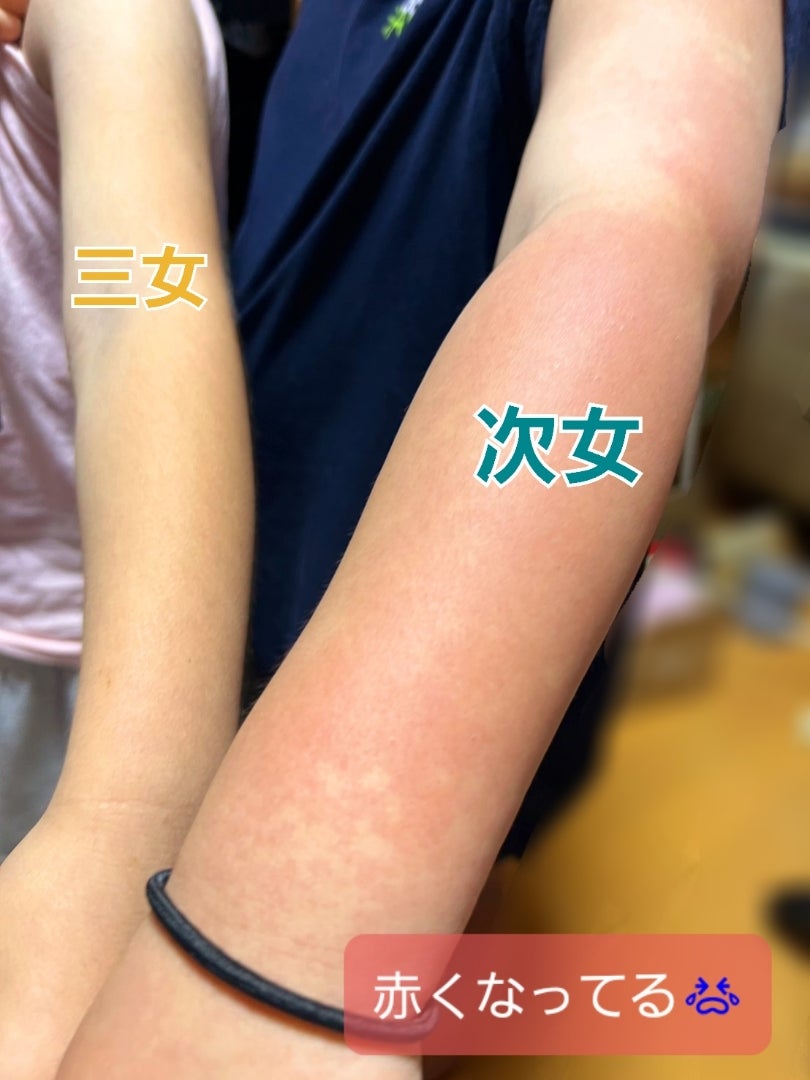 りんご病は病院に行くべき？受診の目安と大人の重症化リスク【2026最新】