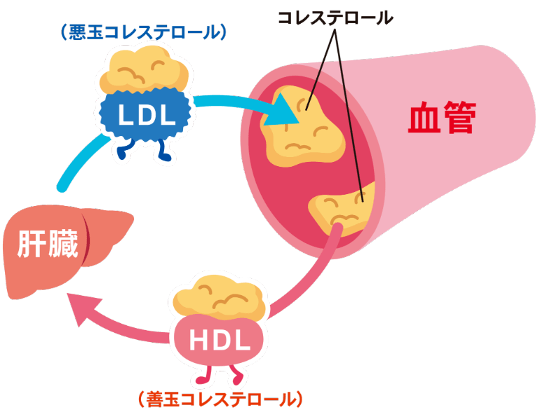 サバ缶で悪玉コレステロールは下がる？Epa効果と食べ過ぎの落とし穴
