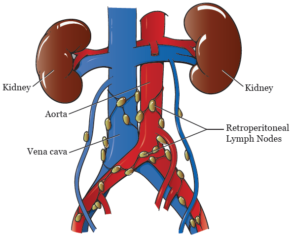 What Are the Retroperitoneal Lymph Nodes