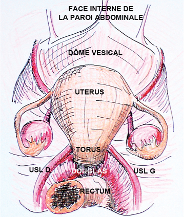 焼肉きんぐ上島店を完全攻略！行列を避けて名物カルビを味わう裏技