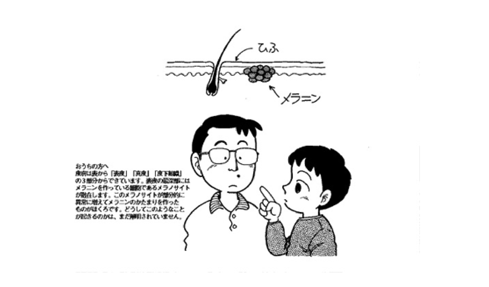 ほくろはなぜできる？急に増える原因とメラノーマ見分け方の真相