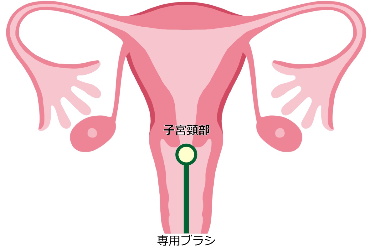 子宮頸がん検診は生理中Ng？受けてはいけない医学的真相と受診基準