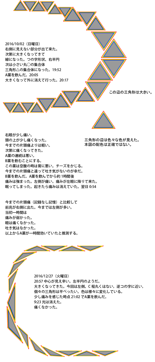 閃輝暗点の原因とは？視界のギザギザや頭痛なしの危険性を徹底解説