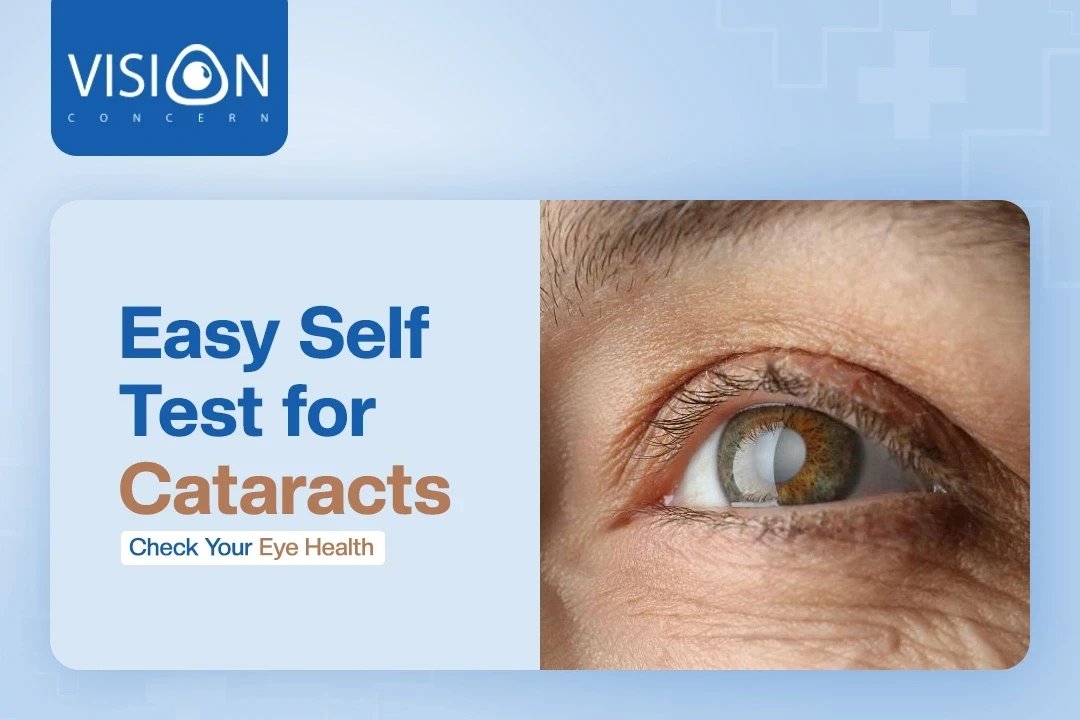 Free Eye Test After Cataract Surgery