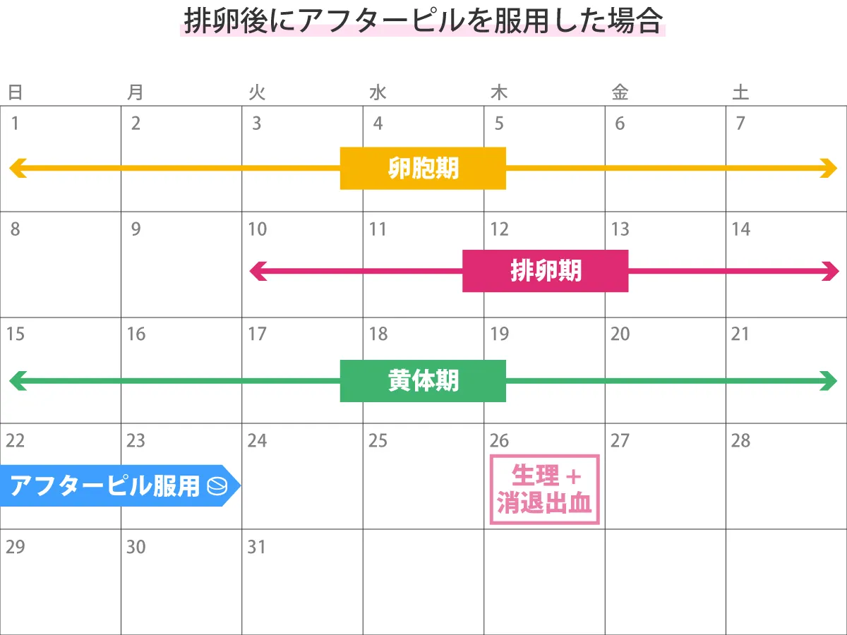 アフターピル後に生理予定日を過ぎた原因と対処法｜妊娠と遅れの境界線