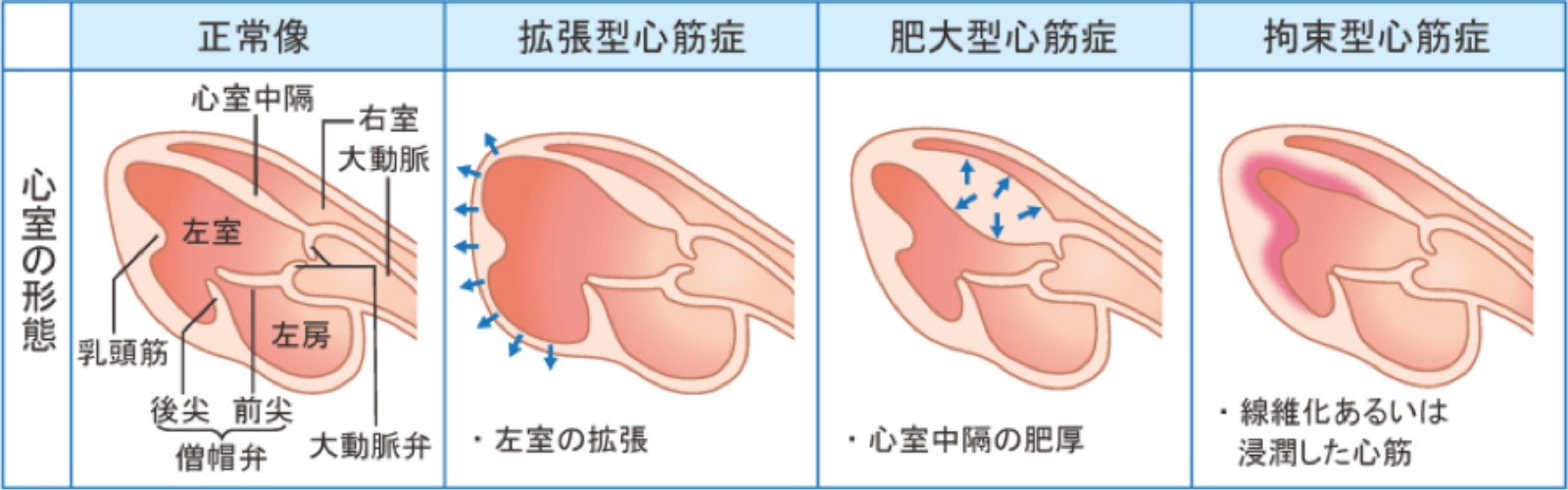 心臓肥大とは？健診の警告を放置するリスクと隠れた原因を徹底解明