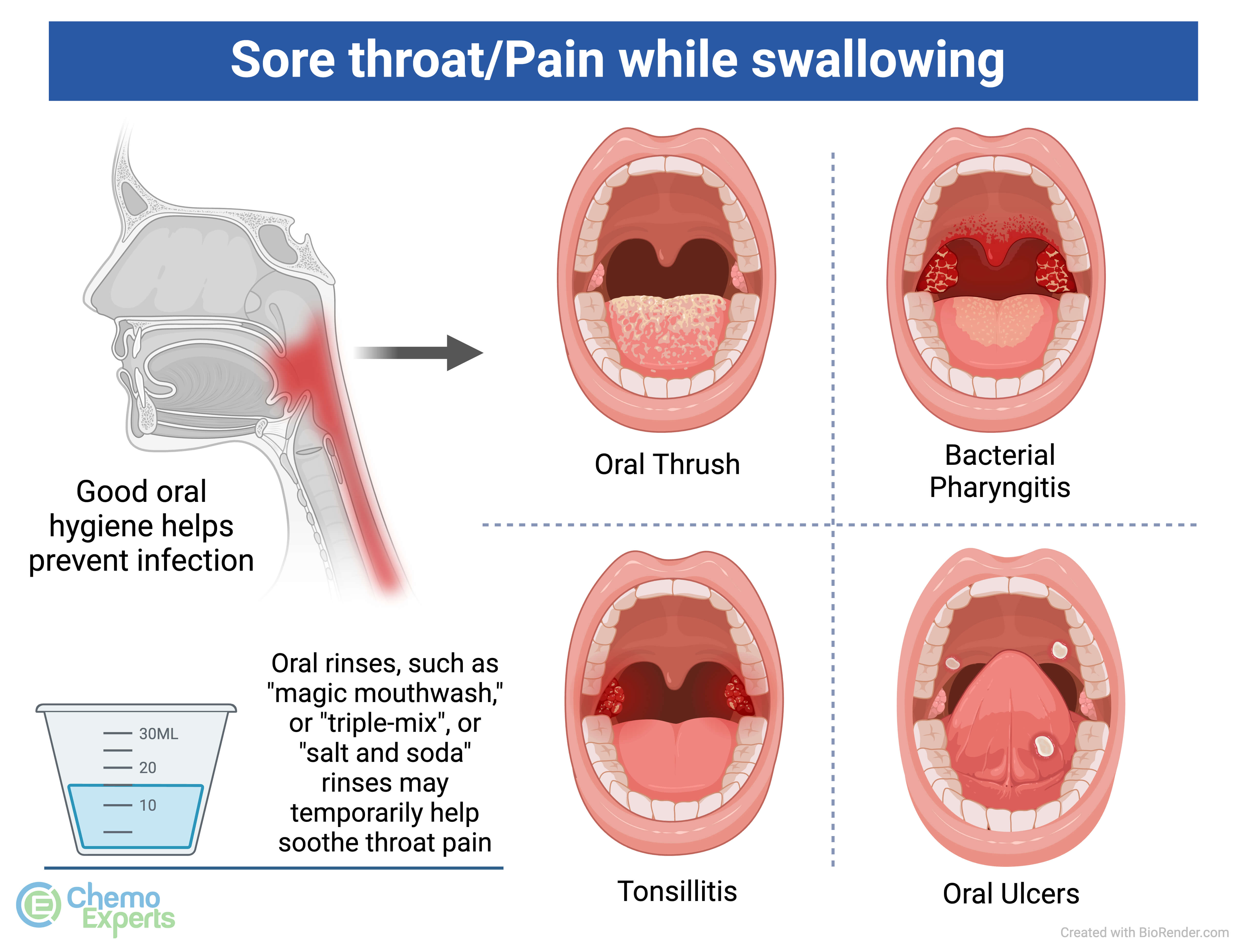 What Does an Inflamed Throat Look Like