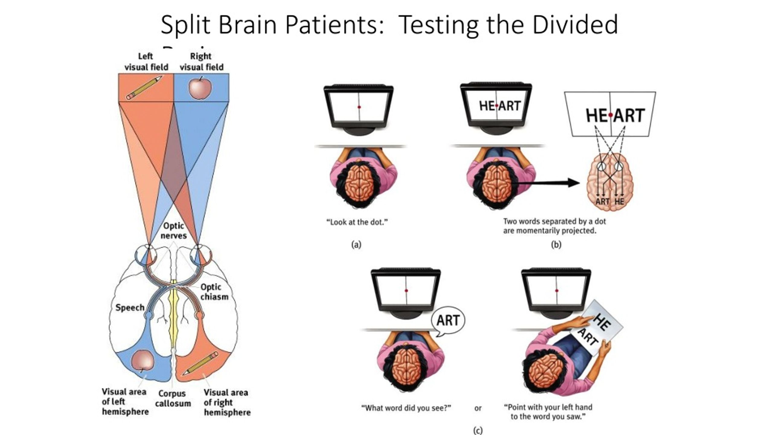 Split Brain Research Ap Psychology Definition