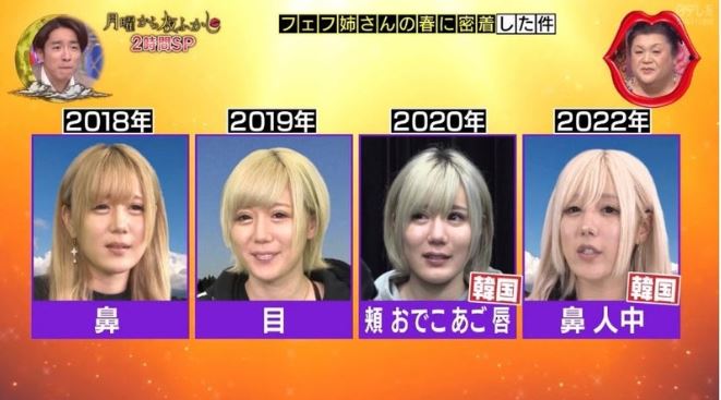 【話題】 多田 さん 整形 前 気になる噂と真相 #950