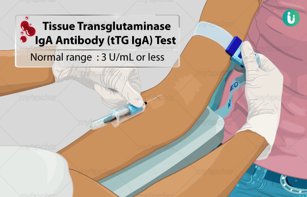 Tissue Transglutaminase Iga 1.0 U/Ml Meaning
