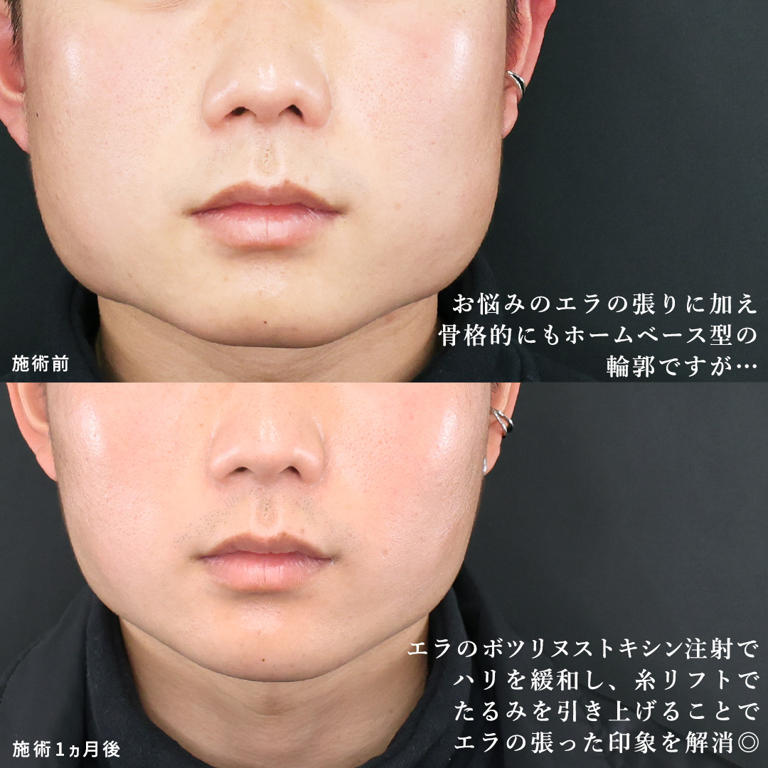 世界を魅了するエラ張りイケメンの秘密！洗練された骨格美と真の魅力