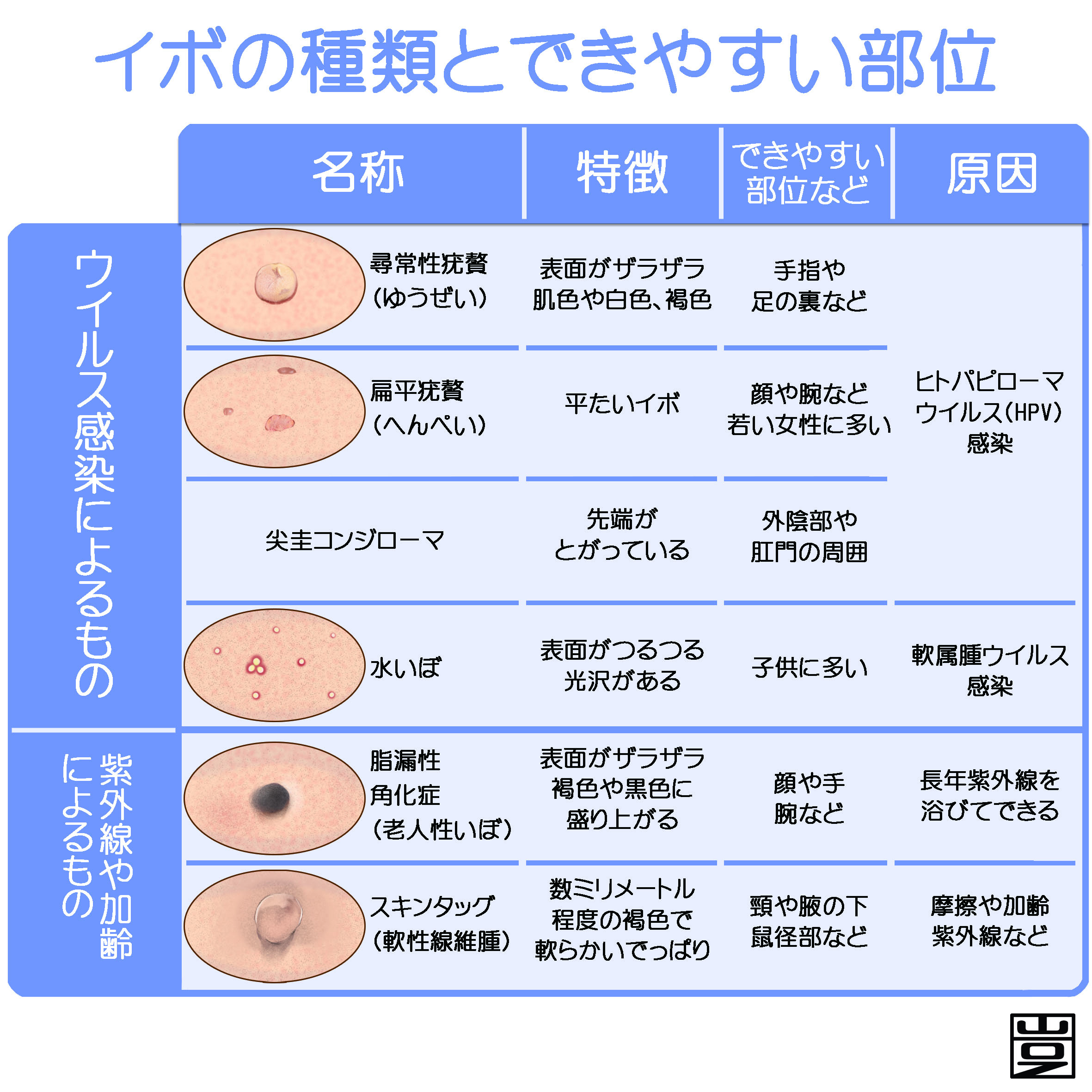 子供のイボ写真で見分ける種類と症状！痛くない最新治療法まで徹底解説