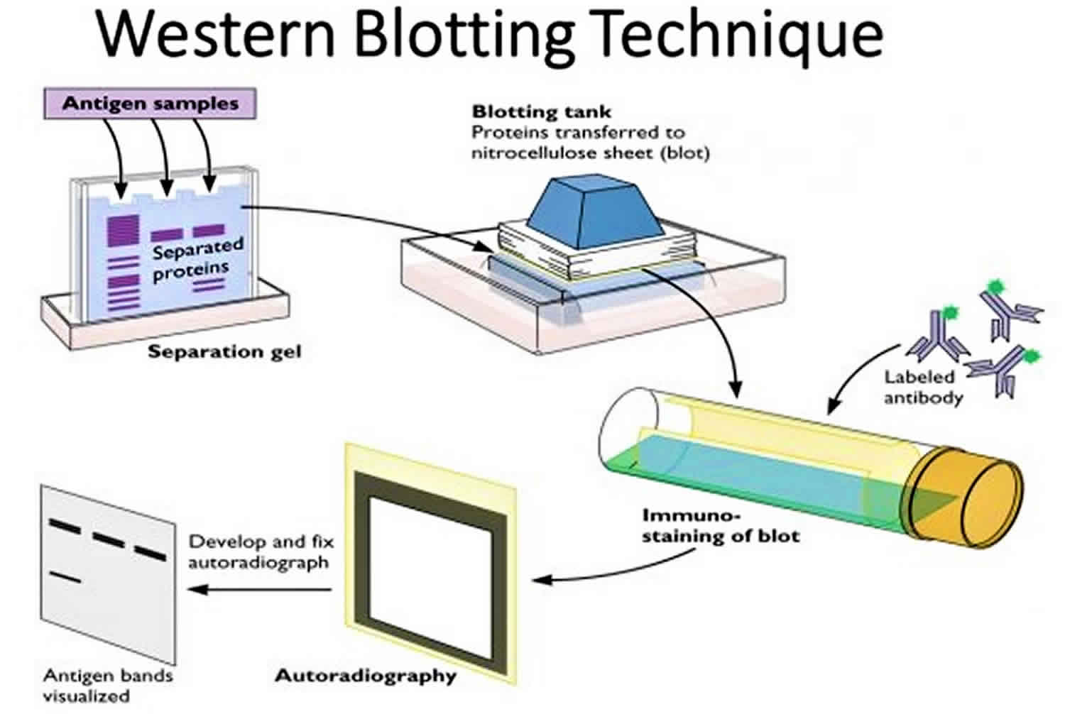 Is Western Blot Capitalized