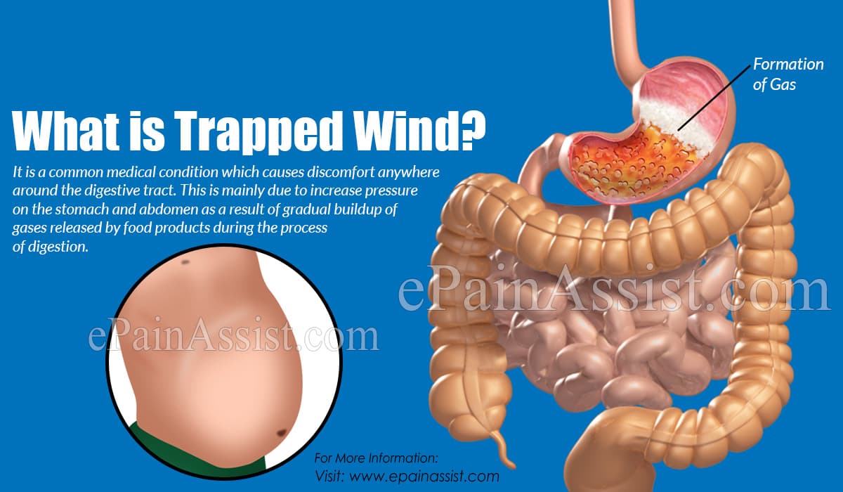 What to Do About Trapped Wind