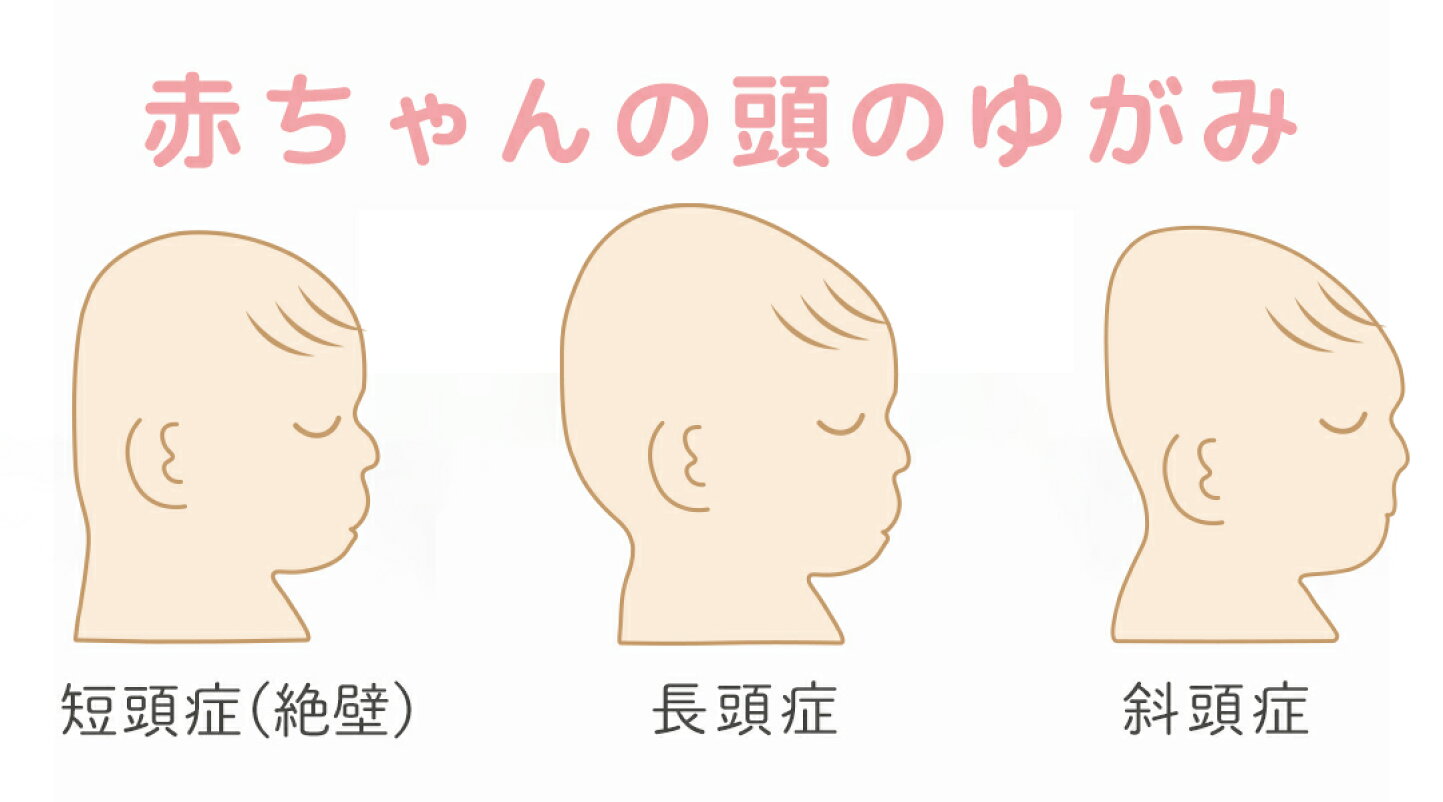絶壁頭は大人でも治る？後頭部の改善法と髪型・医療ケアの真相