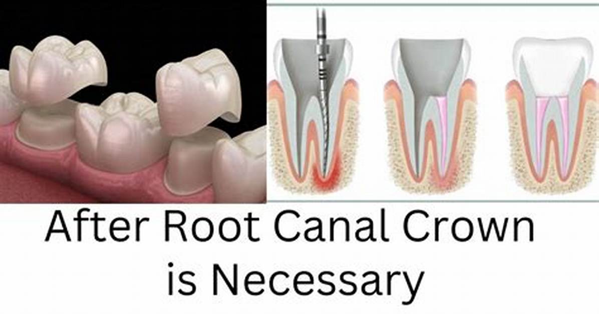 How Do Crown